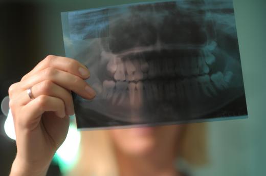 Dental assistants typically are responsible for taking x-rays.